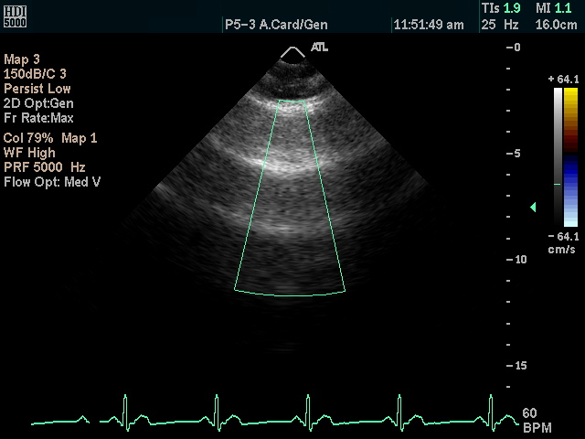 De-identified ultrasound image with masked PHI