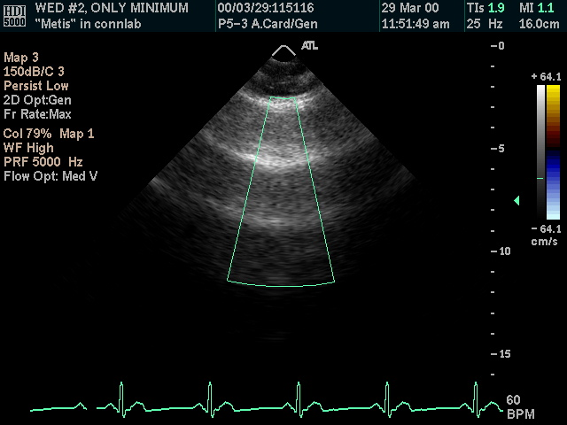 Original ultrasound image with burned-in PHI
